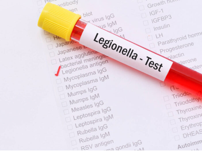 legionella risk assessments - test for legionella
