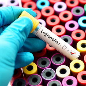 a hand holding a tube with a red check mark and a white label which says 'legionella'