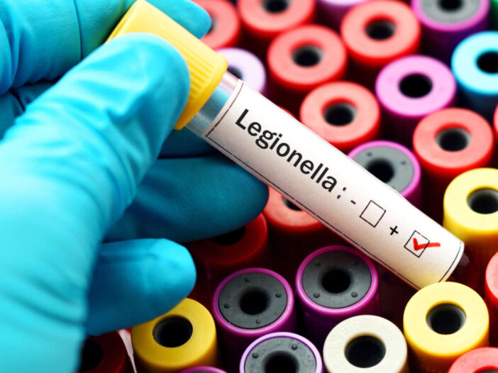 a hand holding a tube with a red check mark and a white label which says 'legionella'