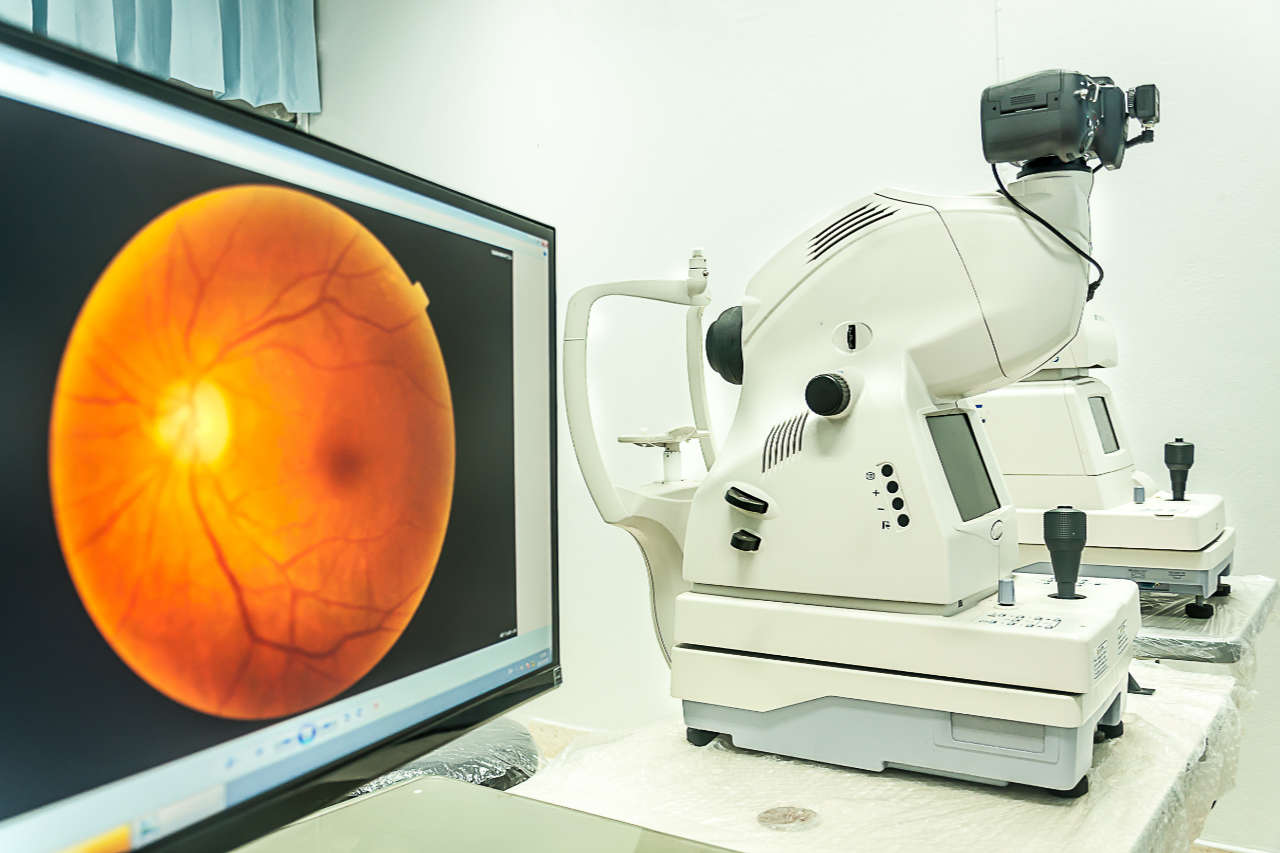 DSE eye tests - optical eye testing machine