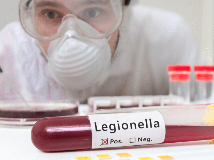 Scientist in a laboratory carrying out legionella testing