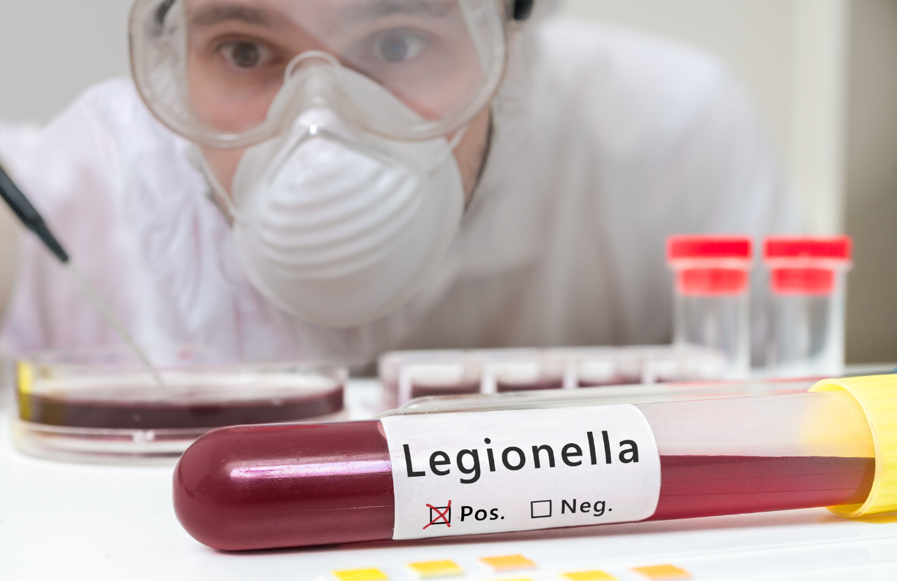 Scientist in a laboratory carrying out legionella testing